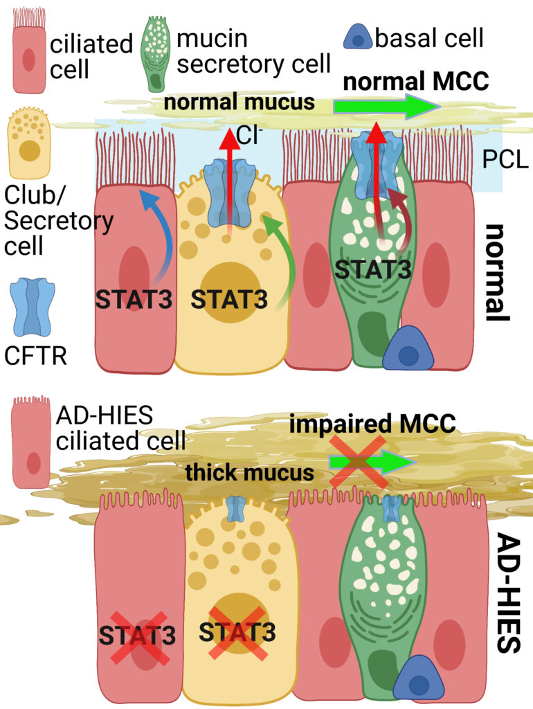 A figure detailing the expression of STAT3 in ciliated cells, mucin secretory c ells, and basal cells, as well as club secretory cells. STAT3 impacts the function of the CFTR channel. 